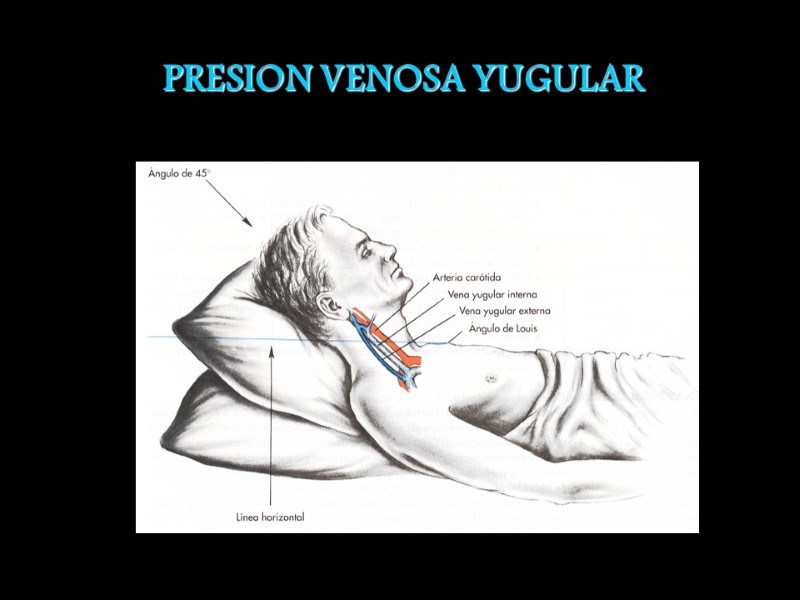 PRESION VENOSA YUGULAR